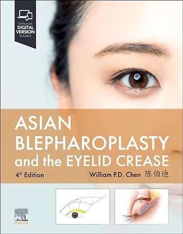 Asian Blepharoplasty and the Eyelid Crease