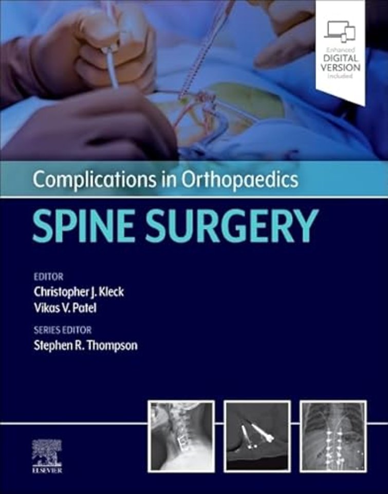Complications in Orthopaedics: Spine Surgery