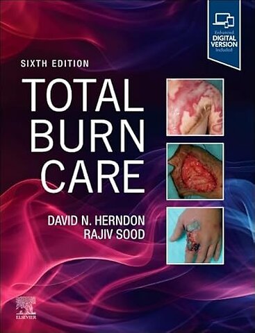 Total Burn Care