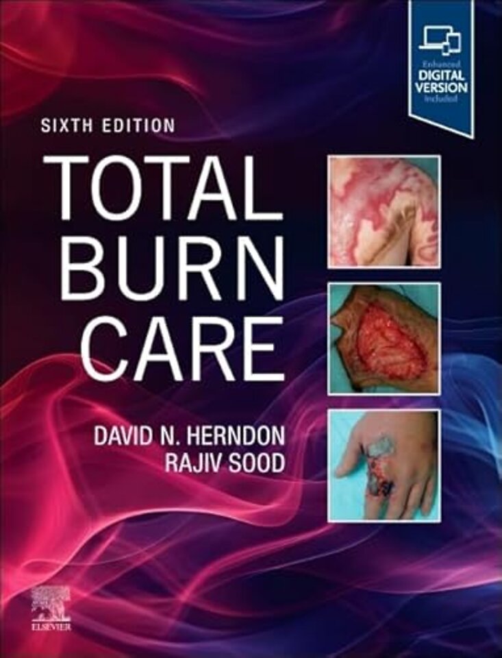 Total Burn Care