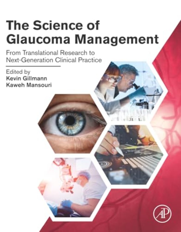 The Science of Glaucoma Management