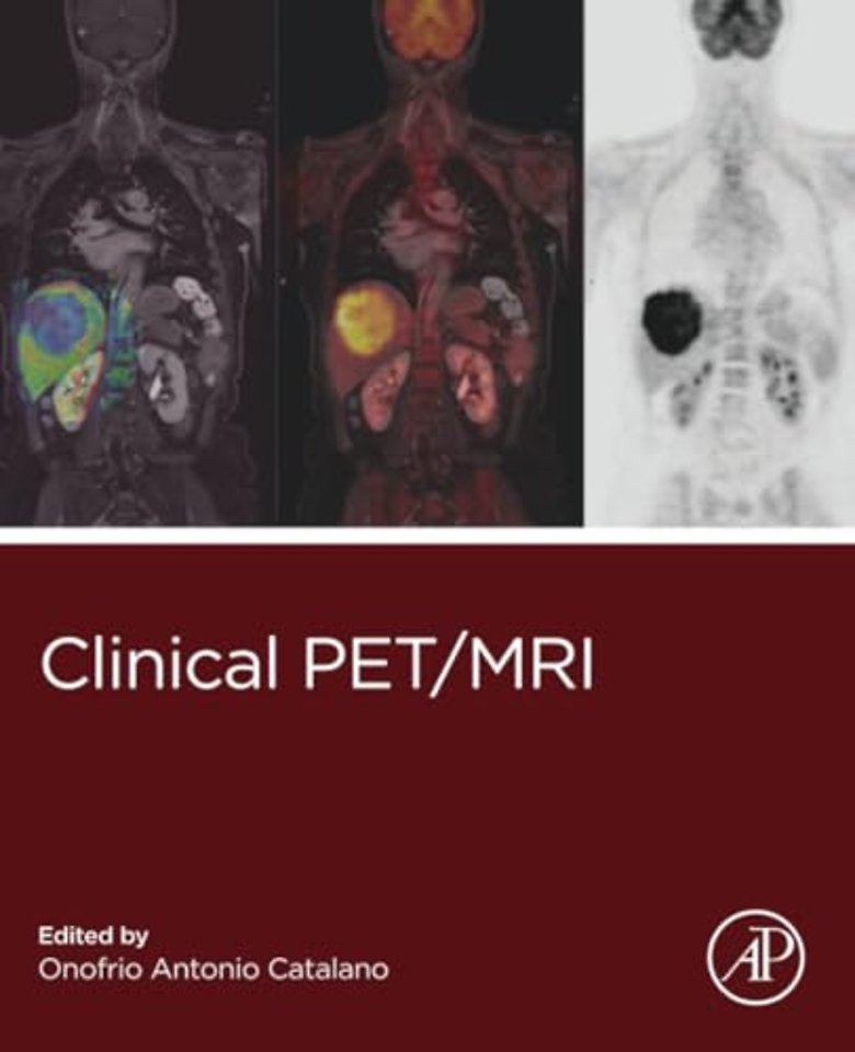 Clinical PET/MRI