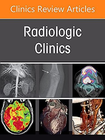 Imaging of Bone and Soft Tissue Tumors and Their Mimickers, An Issue of Radiologic Clinics of North America