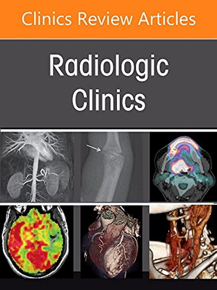 Imaging of Bone and Soft Tissue Tumors and Their Mimickers, An Issue of Radiologic Clinics of North America