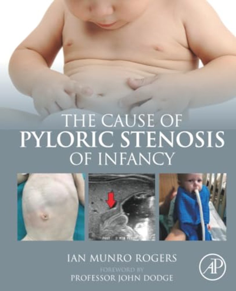 The Cause of Pyloric Stenosis of Infancy