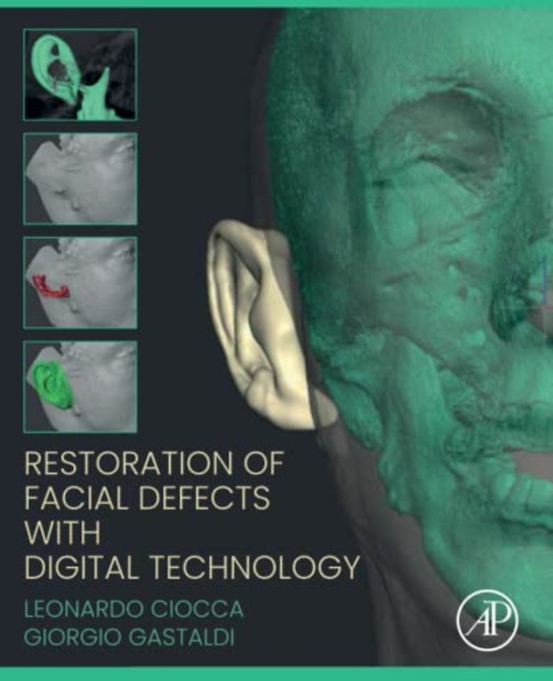 Restoration of Facial Defects with Digital Technology