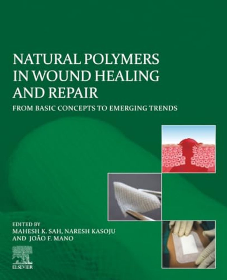Natural Polymers in Wound Healing and Repair