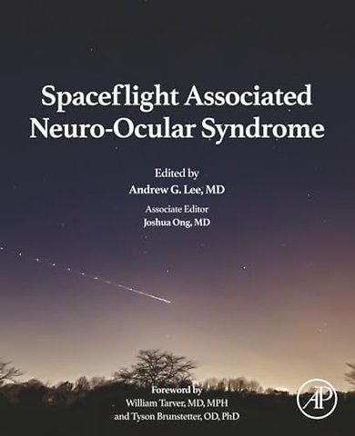 Spaceflight Associated Neuro-Ocular Syndrome