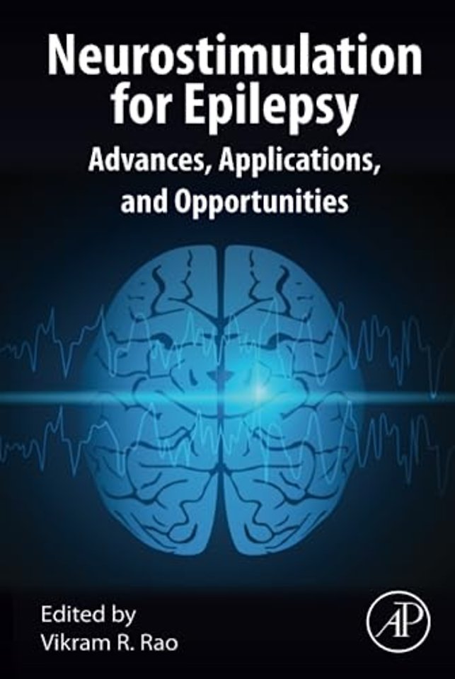 Neurostimulation for Epilepsy