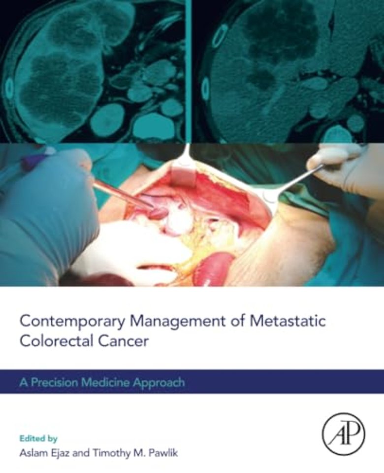 Contemporary Management of Metastatic Colorectal Cancer