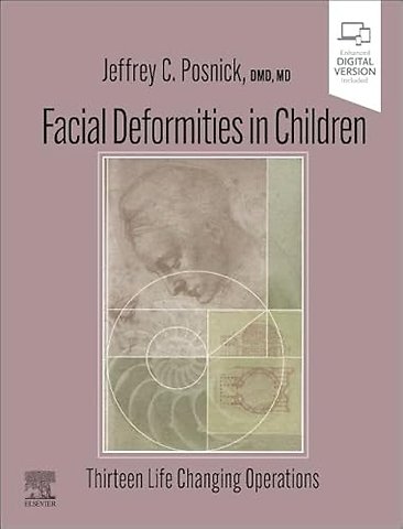 Facial Deformities in Children