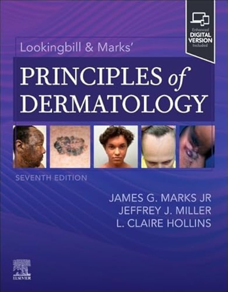 Lookingbill & Marks’ Principles of Dermatology