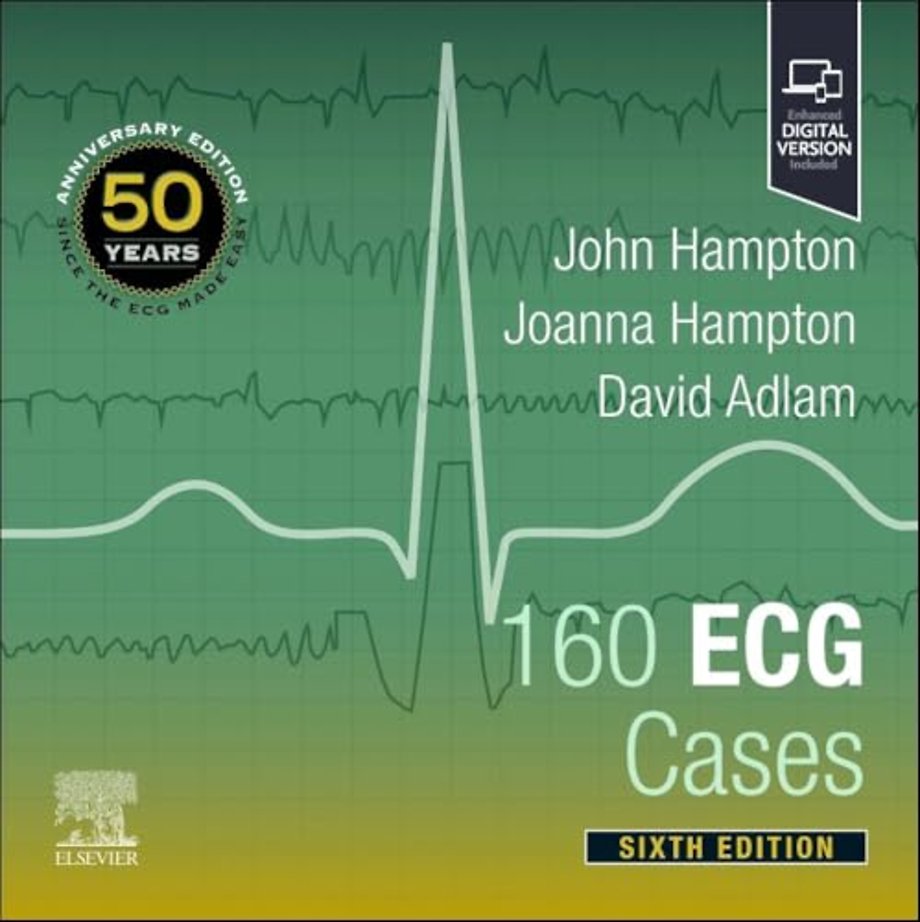 160 ECG Cases