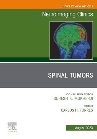Spinal Tumors, An Issue of Neuroimaging Clinics of North America