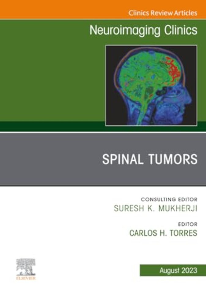 Spinal Tumors, An Issue of Neuroimaging Clinics of North America