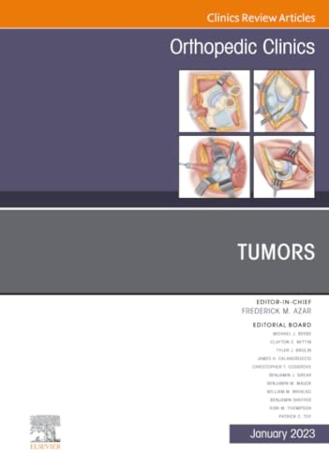 Tumors, An Issue of Orthopedic Clinics