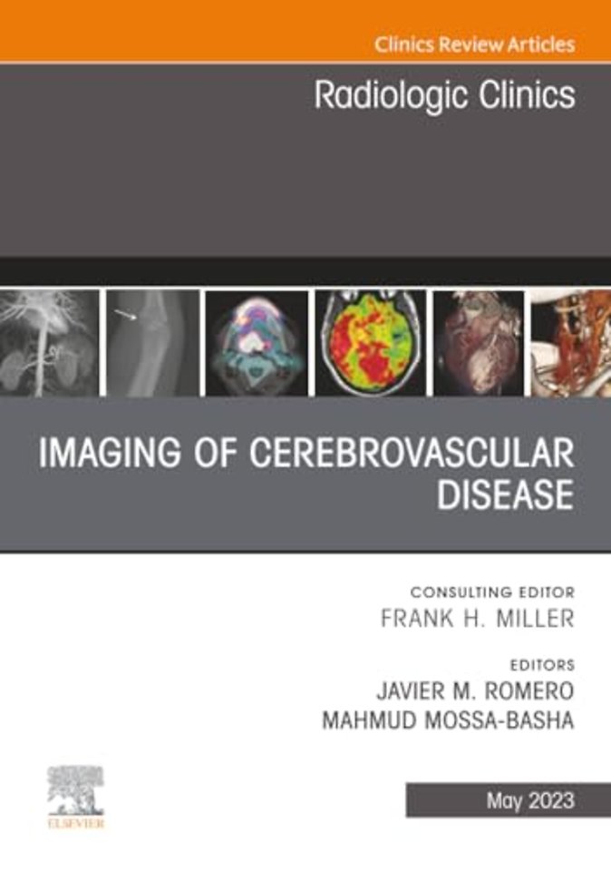 Imaging of Cerebrovascular Disease, An Issue of Radiologic Clinics of North America