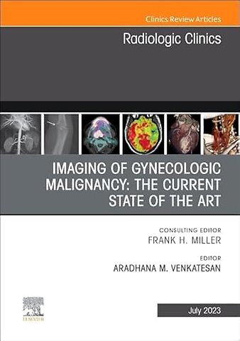 Imaging of Gynecologic Malignancy: The Current State of the Art, An Issue of Radiologic Clinics of North America