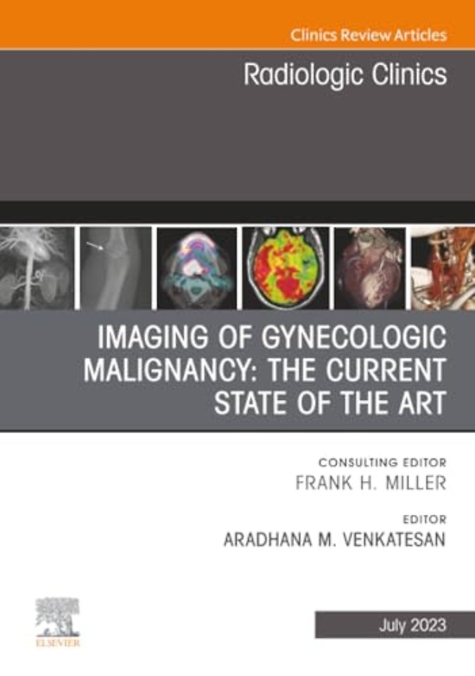 Imaging of Gynecologic Malignancy: The Current State of the Art, An Issue of Radiologic Clinics of North America