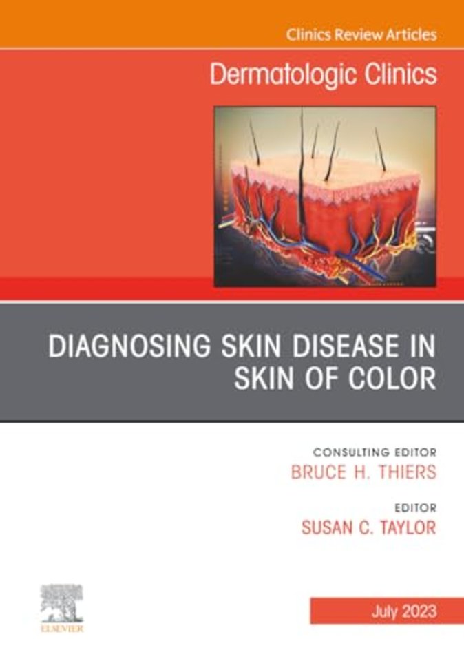 Diagnosing Skin Disease in Skin of Color, An Issue of Dermatologic Clinics
