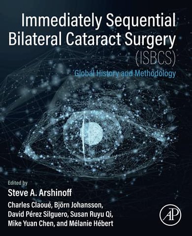 Immediately Sequential Bilateral Cataract Surgery (ISBCS)