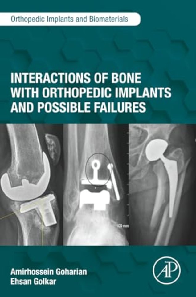 Interactions of Bone with Orthopedic Implants and Possible Failures
