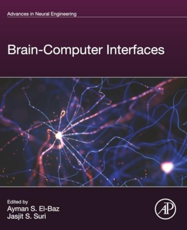 Brain-Computer Interfaces