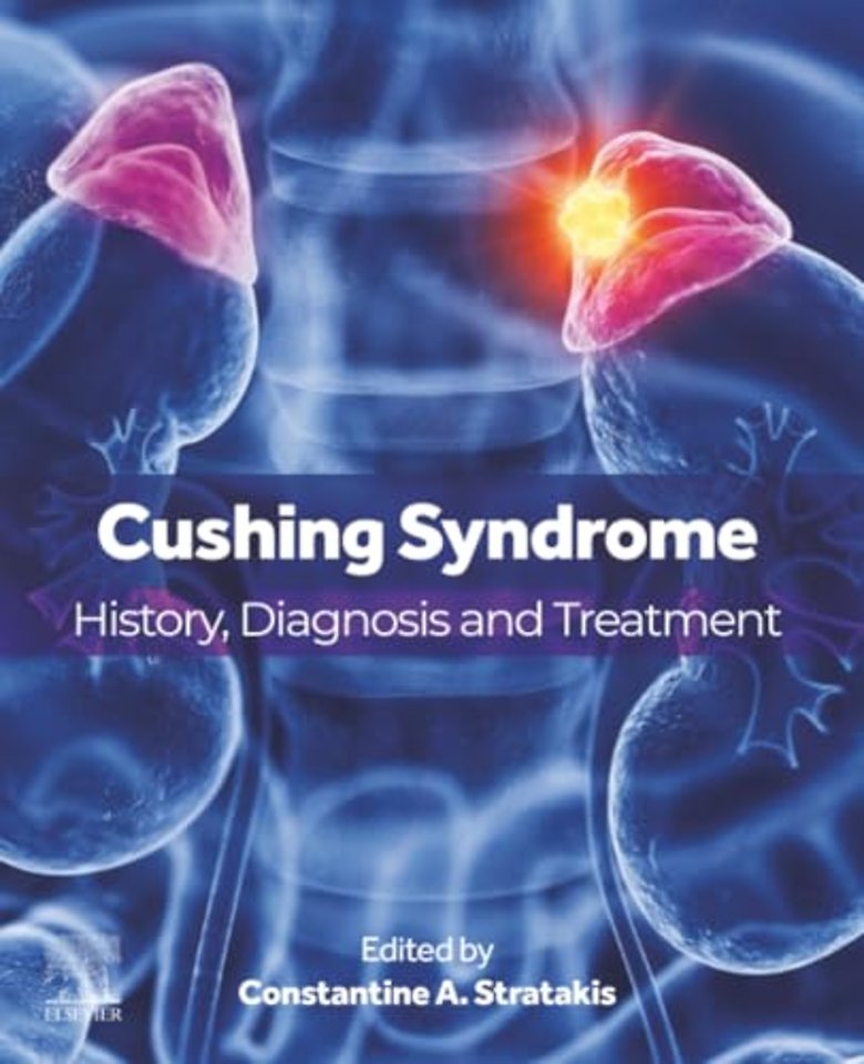 Cushing Syndrome
