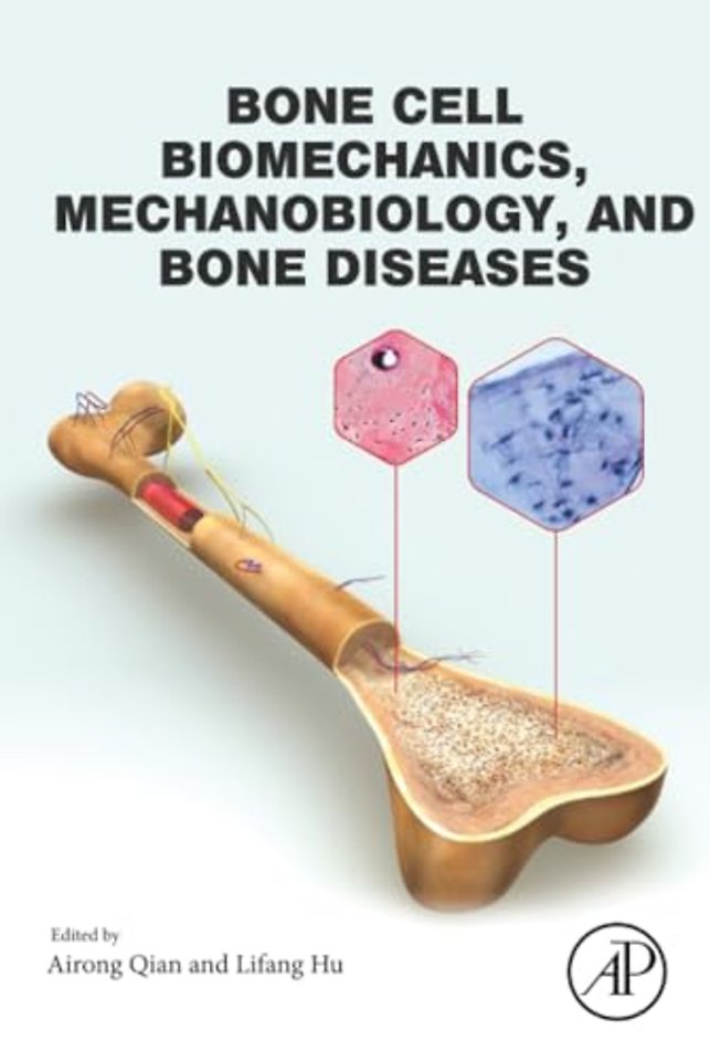 Bone Cell Biomechanics, Mechanobiology and Bone Diseases