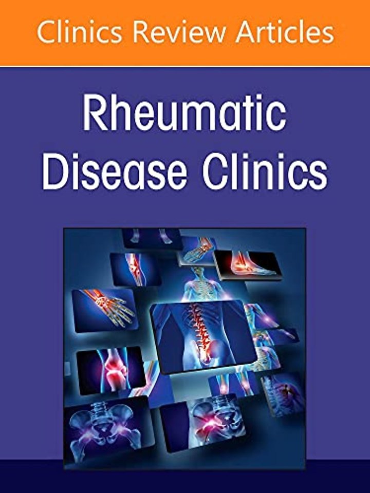 Environmental Triggers for Rheumatic Diseases, An Issue of Rheumatic Disease Clinics of North America
