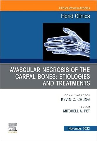 Avascular Necrosis of the Carpal Bones: Etiologies and Treatments, An Issue of Hand Clinics