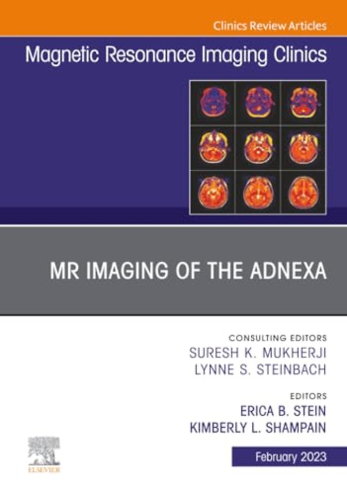 MR Imaging of the Adnexa, An Issue of Magnetic Resonance Imaging Clinics of North America