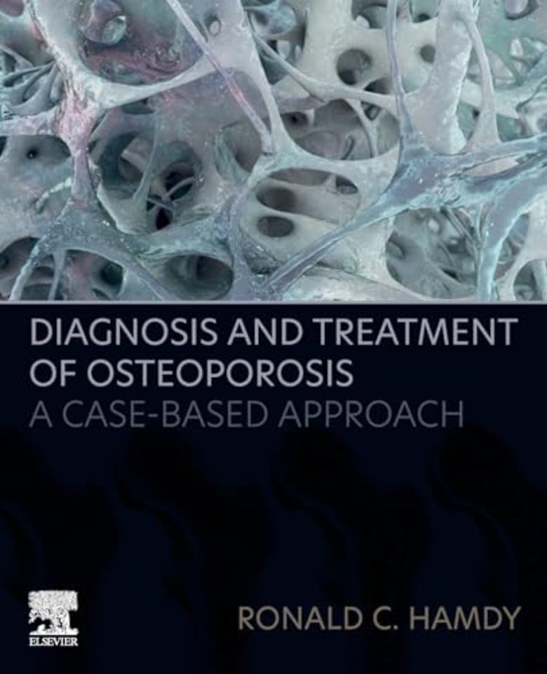 Diagnosis and Treatment of Osteoporosis