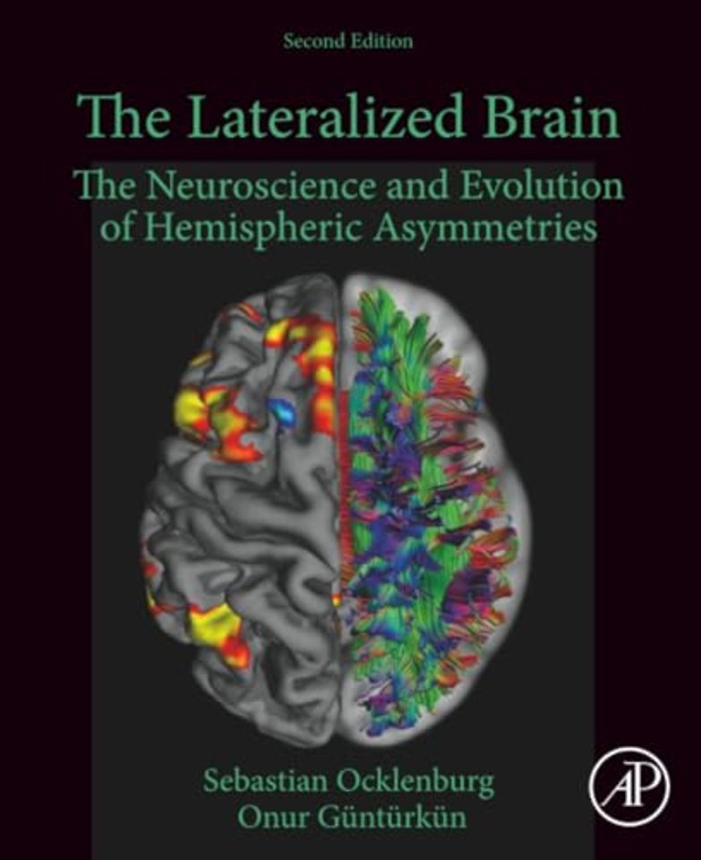 The Lateralized Brain