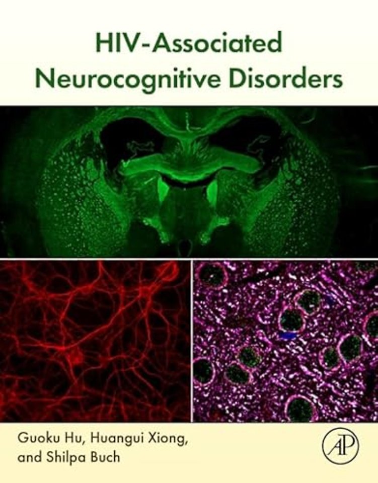 HIV-Associated Neurocognitive Disorders