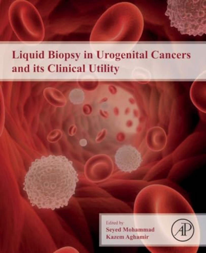 Liquid Biopsy in Urogenital Cancers and its Clinical Utility