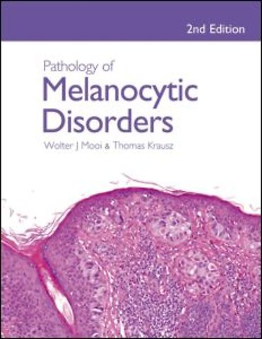 Pathology of Melanocytic Disorders 2ed