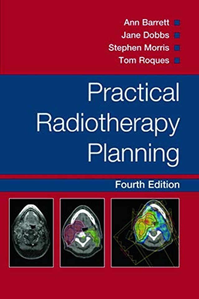 Practical Radiotherapy Planning