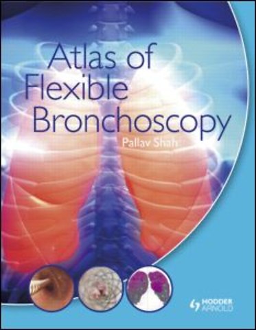 Atlas of Flexible Bronchoscopy