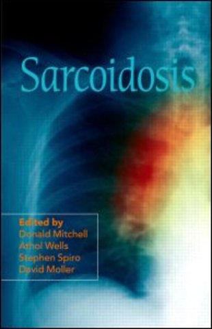 Sarcoidosis