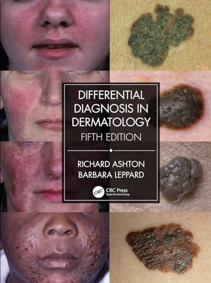 Differential Diagnosis in Dermatology