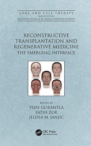 Reconstructive Transplantation and Regenerative Medicine