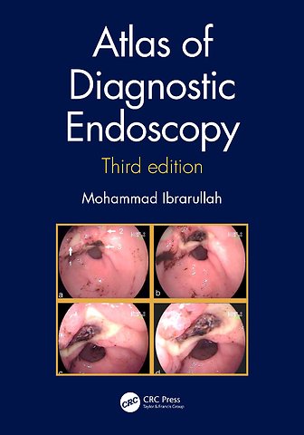 Atlas of Diagnostic Endoscopy, 3E