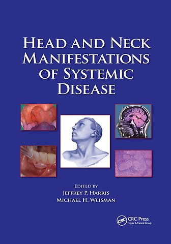 Head and Neck Manifestations of Systemic Disease