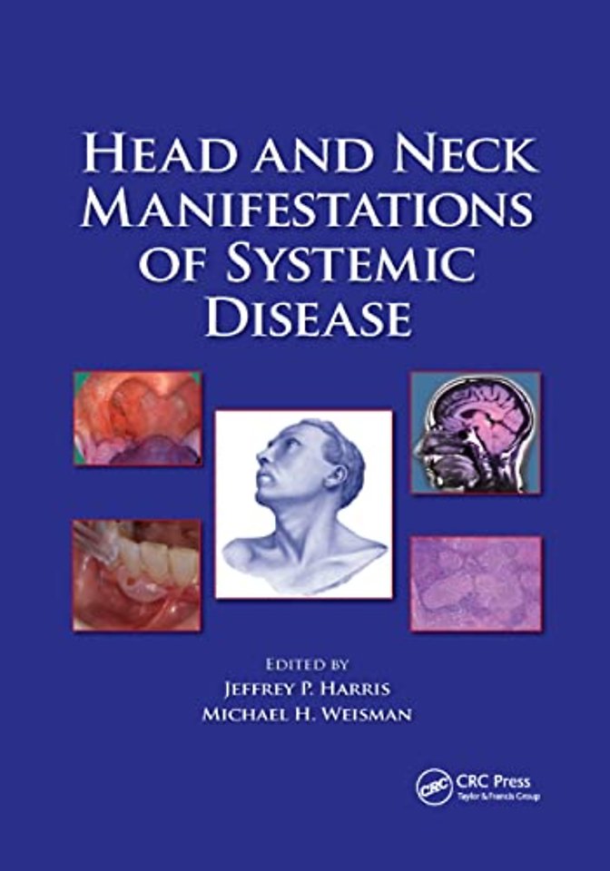 Head and Neck Manifestations of Systemic Disease