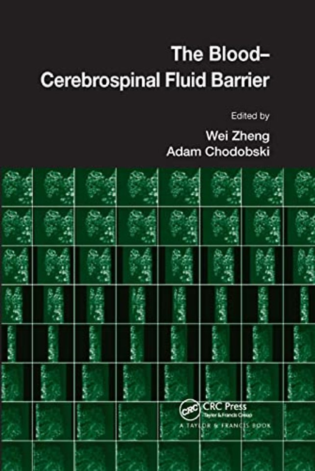 Blood-Cerebrospinal Fluid Barrier