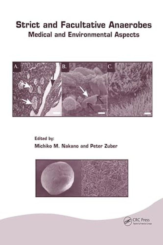 Strict and Facultative Anaerobes
