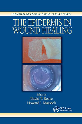 Epidermis in Wound Healing