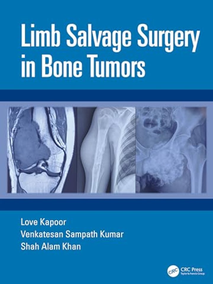 Limb Salvage Surgery in Bone Tumors