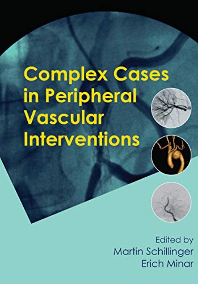 Complex Cases in Peripheral Vascular Interventions
